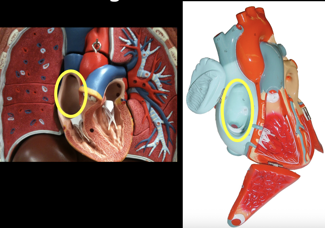<p>what part of the heart muscle is shown?</p>