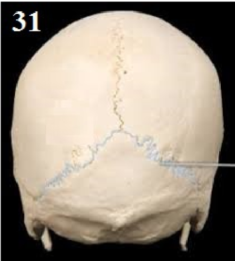 <p>Name This Suture</p>