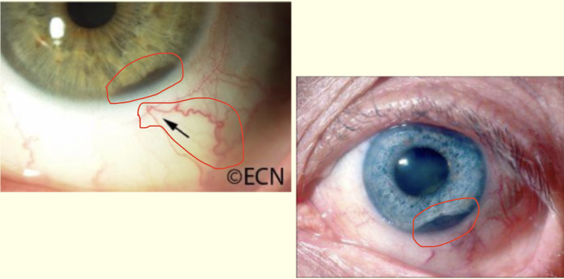 <p>Describe and give diagnosis </p>