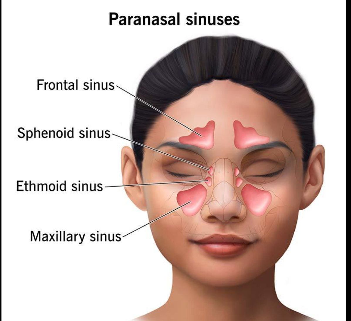 <p>Air-filled spaces in the frontal, maxillary, ethmoid, and sphenoid bones.</p><p>Help lighten the skull, produce mucus, and add resonance to the voice.</p><p>Inflammation of the nasal mucosa is called rhinitis. Inflammation of the sinuses is sinusitis.</p>
