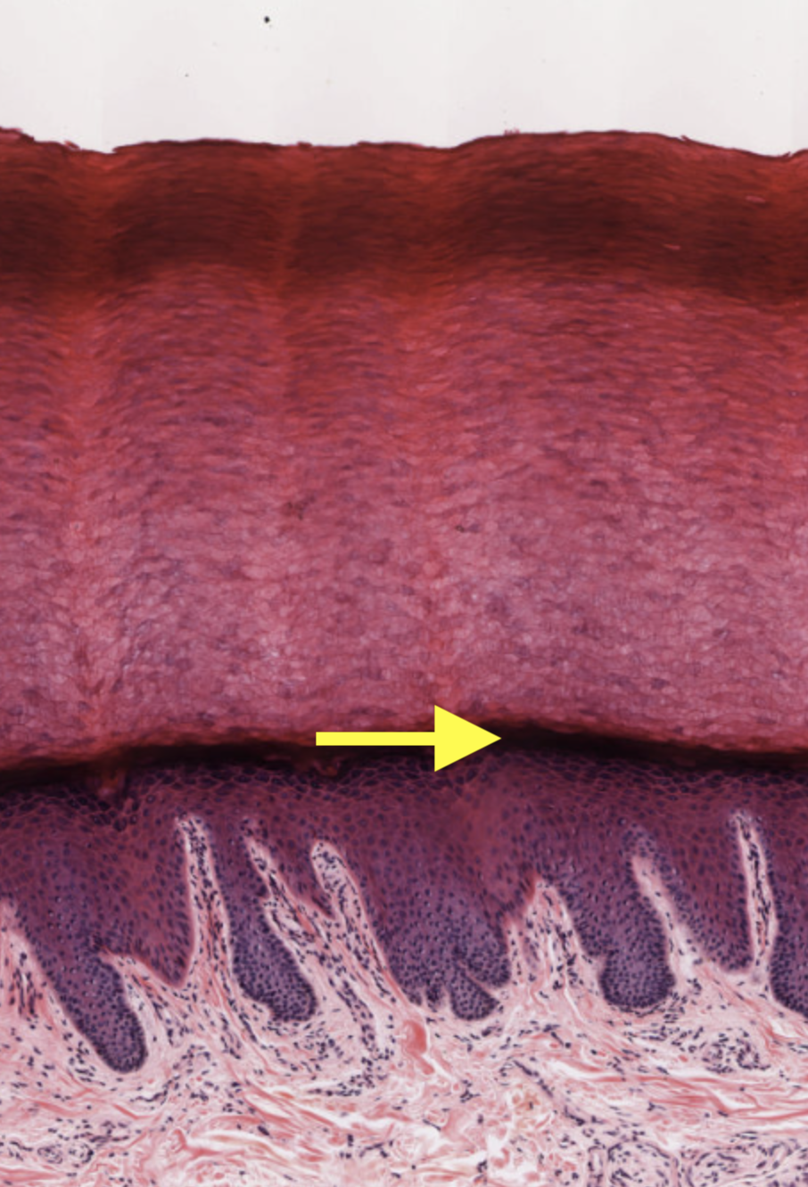 <p>Name the layer of the epidermis indicated by the arrow</p>