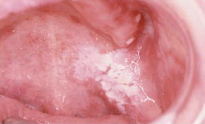 <p>what is this condition</p>