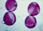 <p>Type pof pollen? </p>