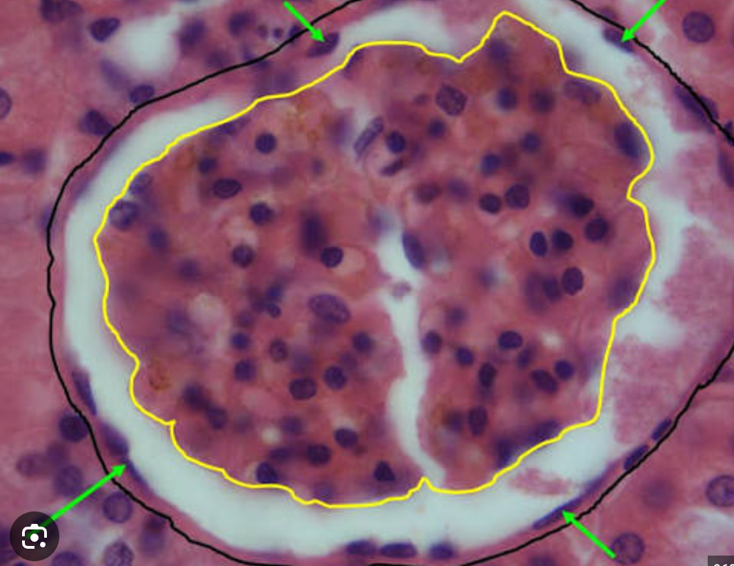 <p>What are green arrows pointing to (glomerulus)</p>