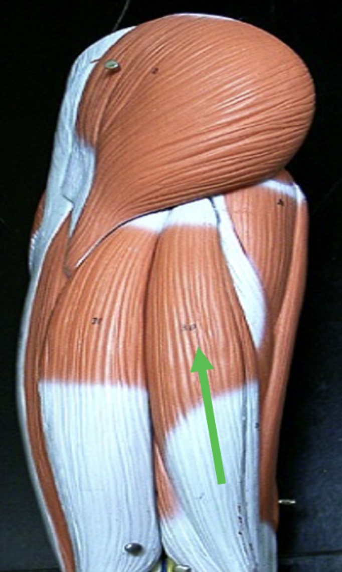 <p>Identify the muscle indicated by the pointer.</p>