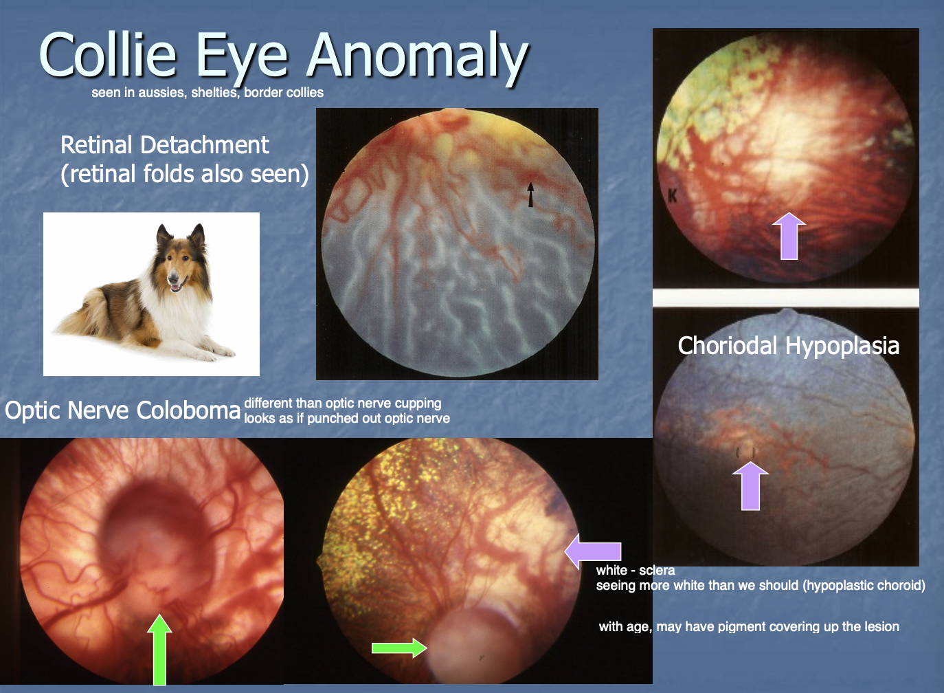 <p>one or multiple of the anomalies associated w/ dz.</p>