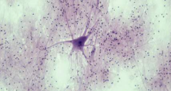 <p>Tissue: Consists of nerve cells called neurons and supportive cells called neuroglia. Processes and carries info throughout the nervous system.</p>