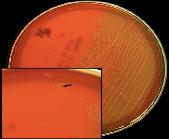 <p>what kind of hemolysis (green)</p>