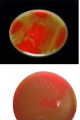 <p>What type of hemolysis is described for a sample believed to be Staphylococcus aureus that is seen in this photo?</p>