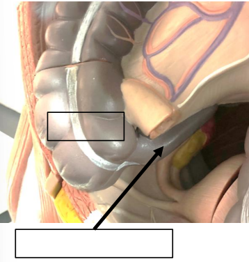 <p>Label this image.</p>