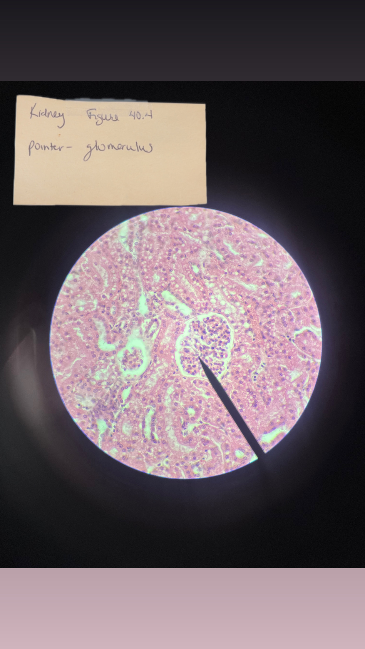 <p>KIDNEY</p>