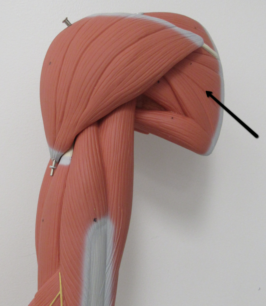 <p>Identify the muscle indicated by the pointer.</p>
