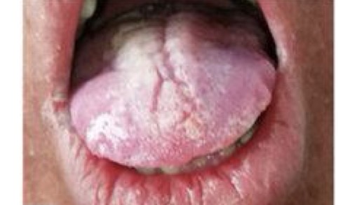 <p>CHẨN ĐOÁN?</p>