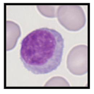 <p>- Age-dependent reference ranges</p><p>- Average life span 4 years (up to 10 years)</p><p>.</p><p>Two major functionally distinct groups, B- and T-cells</p><p>- PB: T (70-85%) and B (5-25%) lymphocytes</p><p>- Also natural killer cells (large granular lymphocytes <5%)</p><p>.</p><p>- T cells: Cell mediated immunity</p><p>.</p><p>B cells:</p><p>- Produce immunoglobulins (groups of proteins)</p><p>- Further development of B lymphocytes in lymph nodes</p>