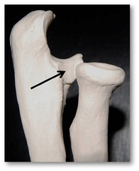 <p>Where the radius will attach to the ulna</p>