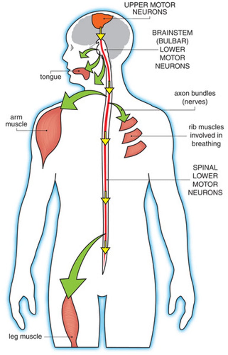 <p>(A) Diminished Reflex</p><p>If there is a problem with lower motor neurons, a diminished or lost reflex will be observed.</p><p>A similar effect would be seen if the somatosensory neurons (afferent neurons) were affected too.</p>