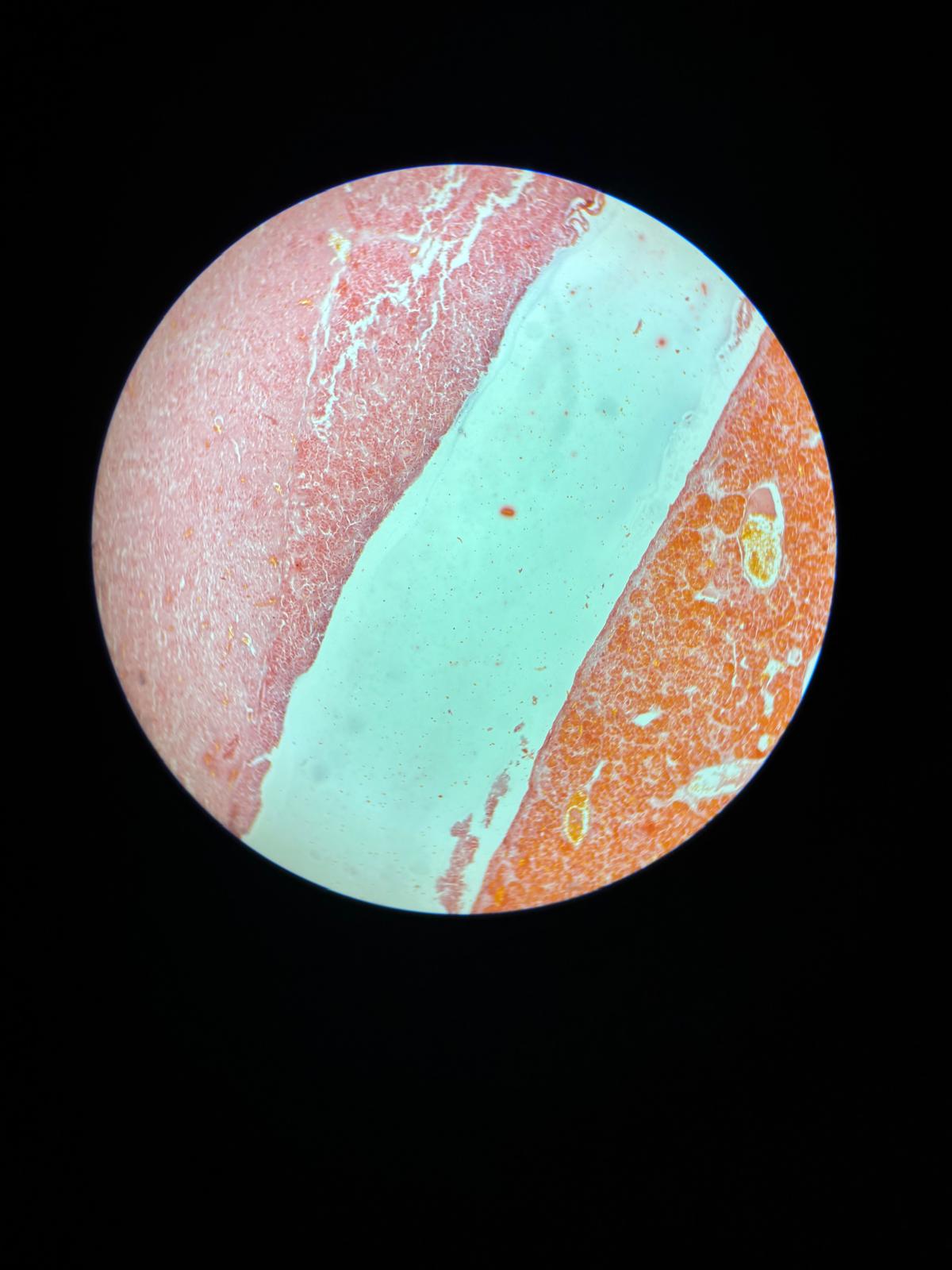 <p>Composed of the Adenohypophysis (Part distalis and Intermediate Part) and the Neuro Hyb Physis (nervous part); contains Basophil and Acidophil cells.</p>