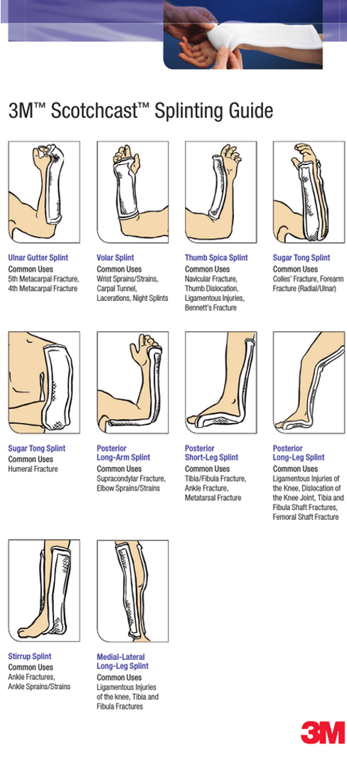 <ul><li><p>Involves the tendons of the forearm flexors at the medial epicondyle</p></li><li><p>Causes</p><ul><li><p>Overuse/activity (repetition)</p></li><li><p>Heavy lifting</p></li><li><p>Trauma</p></li><li><p>Weak UE</p></li></ul></li><li><p>Presentation</p><ul><li><p>Most common in dominant arm</p></li><li><p>Pinpoint tenderness over the medial epicondyle</p><ul><li><p>+/- swelling along the medial epicondyle or proximal forearm</p></li></ul></li><li><p>Soreness of the forearm flexors</p></li></ul></li><li><p>Diagnosis</p><ul><li><p>Is a <strong>clinical</strong> diagnosis: do not need imaging</p></li></ul></li><li><p>Treatment</p><ul><li><p>Conservative</p><ul><li><p>Rest</p></li><li><p><strong>Activity modification</strong></p></li><li><p>Brace</p></li><li><p>NSAIDs: mainstay</p></li><li><p>Topicals</p></li><li><p>Cortisone injections</p></li><li><p>PT/OT</p></li></ul></li><li><p>Surgical</p><ul><li><p>Medical epicondylar debridement</p><ul><li><p>Tendon is reinforced with suture to decrease micro-friction </p></li><li><p>Multilayer closure</p></li><li><p>Immobilization: long arm splint for up to 2 weeks</p></li></ul></li></ul></li></ul></li></ul><p></p><p></p>