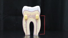 <p>Portion that is covered with dentin.</p>