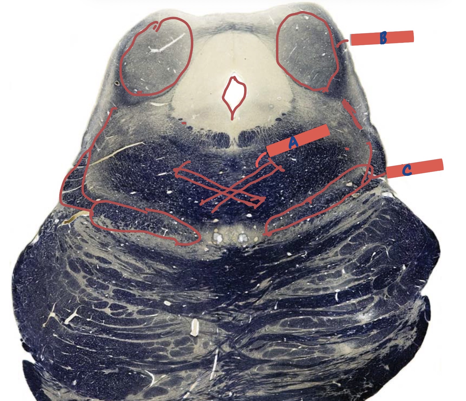 <p>What layer is this?</p>