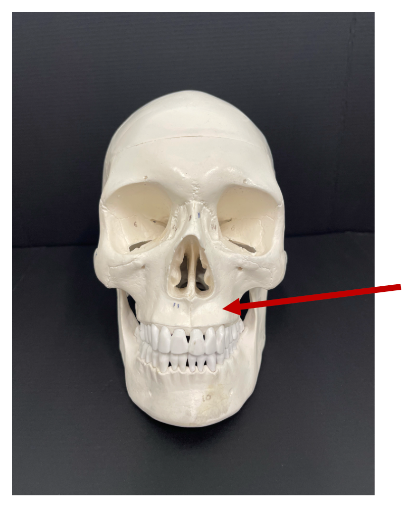 <p>What major bone of the face is the arrow pointing to?</p>
