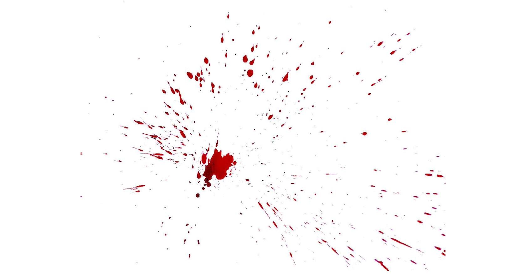 <p>A radials spatter is indicative that there was an impact (the larger pool), which sent blood droplets traveling away from the impact at high speed. This indicates that the impact occurred with significant force.</p>