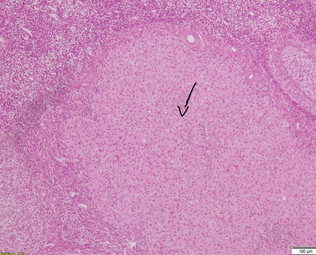 term image