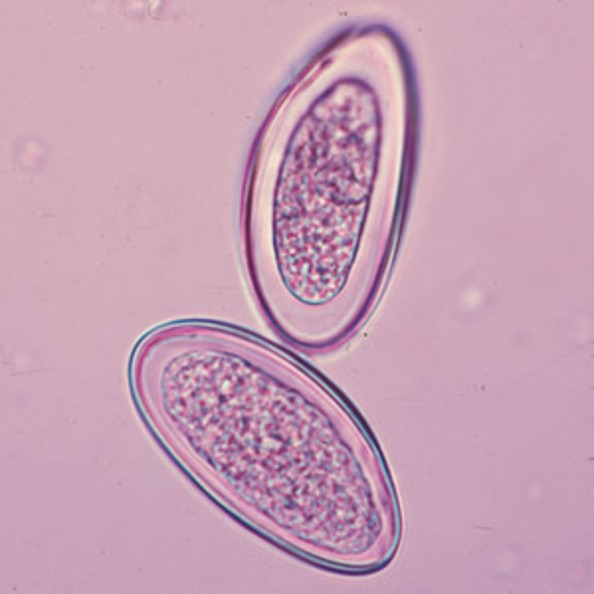<p>Identify the organism</p>