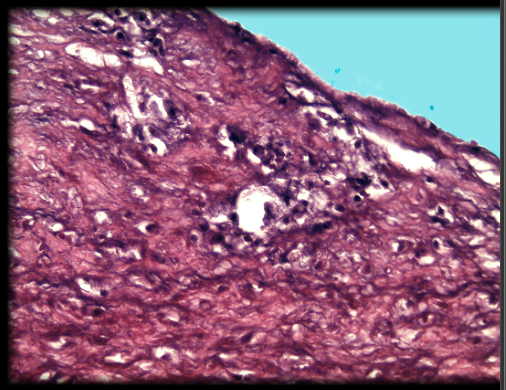 <p>vessel wall contains large amounts of elastic protein fibers</p>