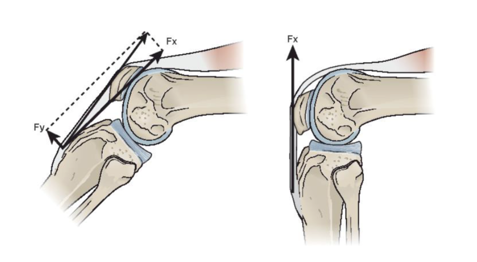 <p>Fy (anterior shear + flexion) </p><p></p><p>Fx (parallel → compress tibia into femur) </p><p></p><p>@ 60 flexion → quads do NOT make anterior shear → No strain to ACL</p>