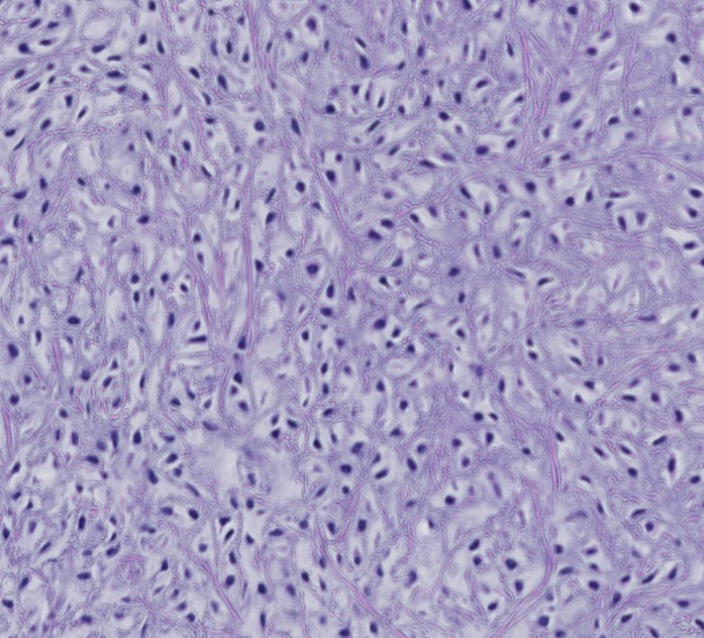 <p>The iris diaphragm is enclosed to naturally enhance glowing fibers, indicating this is which type of cartilage in the larynx?</p>