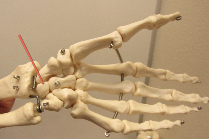 <p><span><strong>Identify the bone marking indicated by the pointer.</strong></span></p>