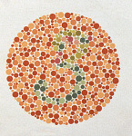 <p>Inability to distinguish some or all colors due to a damaged cone.</p>