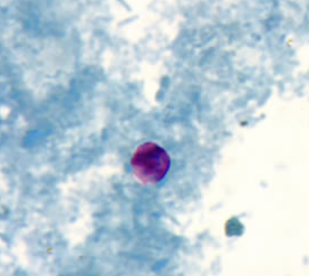 <p>What parasite is this?</p>