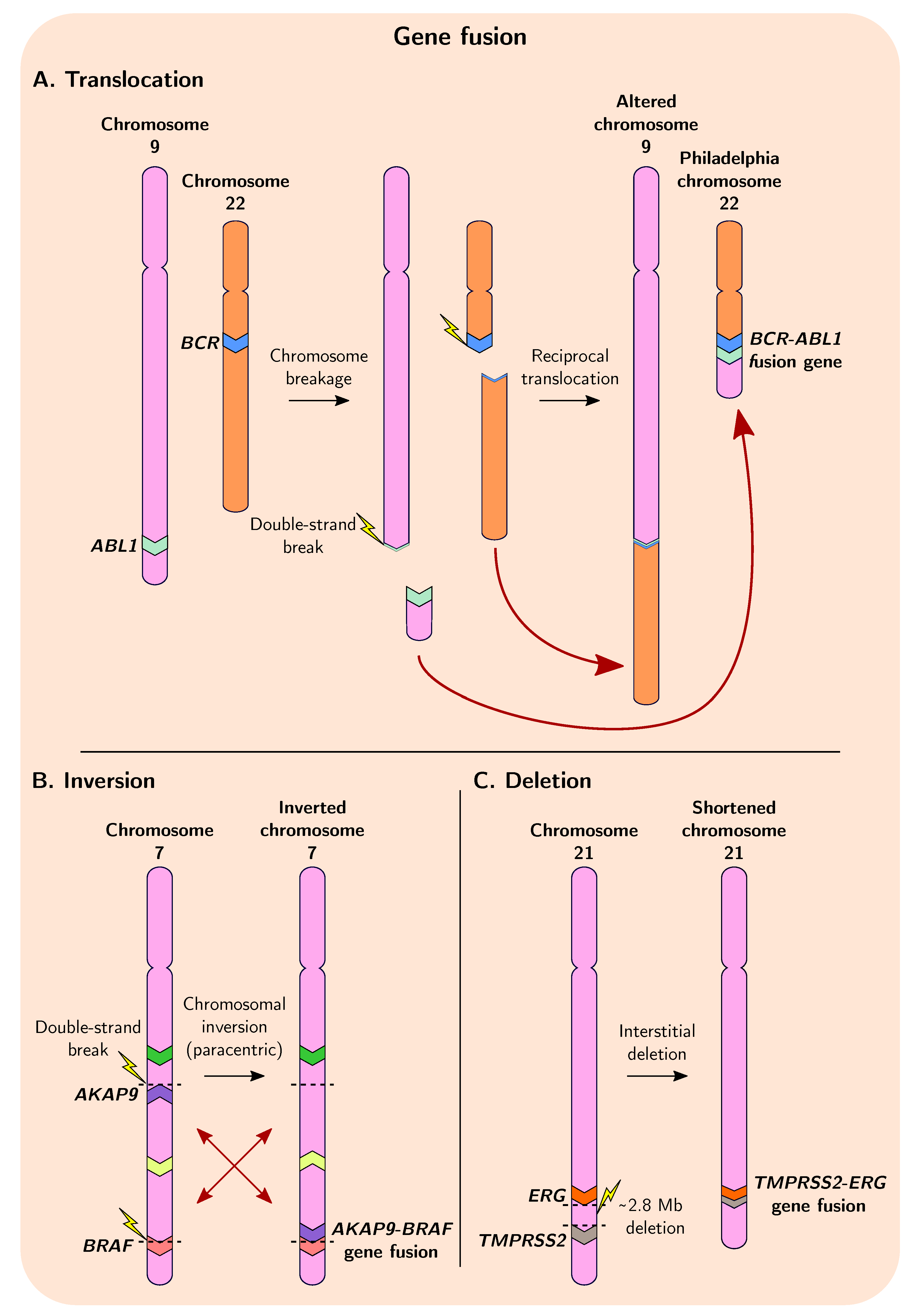 <p><strong>Chromosomal translocation</strong> involves the <strong>fusion</strong> of a proto-oncogene with another gene, leading to <strong>loss of regulation</strong> and <strong>abnormal cell division</strong>.</p><p></p><p>fusion example BCR -ABL (a segment of abl gene on chromosome 9 breaks off and attaches to bcr on chromosome 22)</p><p></p><ul><li><p><span style="color: blue;">at chromosomal level its a swap (two chromosomes exchange segments with each other, both chromosomes are altered).</span></p></li><li><p><span style="color: blue;">at the gene level its a fusion, as a result of the swap, created a hybrid gene.</span></p></li></ul><p></p>