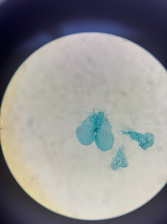 <ul><li><p><strong>Haploid</strong></p></li><li><p><strong>Heart‑shaped</strong>, tiny, green</p></li><li><p><strong>Hermaphroditic </strong>(has both antheridia + archegonia)</p></li><li><p>Male: <strong>antheridia</strong> on edges (small green circles)</p></li><li><p>Female: <strong>archegonia</strong> in center (larger dark circles)</p></li></ul><p></p>