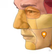 <p>Buccal</p>