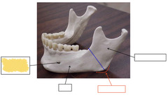 <p>Mandible</p>