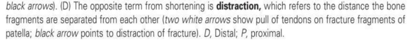 <p>distraction</p>