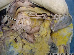 <p>what vein is pictured here?</p>