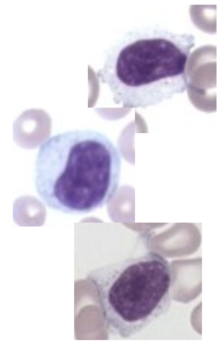 <ul><li><p><span style="background-color: transparent;">identify, target, and destroy pathogens (bacteria, viruses), abnormal cells (cancer), and toxins. They also retain "memory" of past infections to prevent you from getting sick from the same threat twice. B-cells and T-cells</span></p></li><li><p><span style="background-color: transparent;">Lifespan: weeks to months, but memory cells can last years</span></p></li><li><p><span style="background-color: transparent;">Differential percentage: 15-45%</span></p></li></ul><p></p>