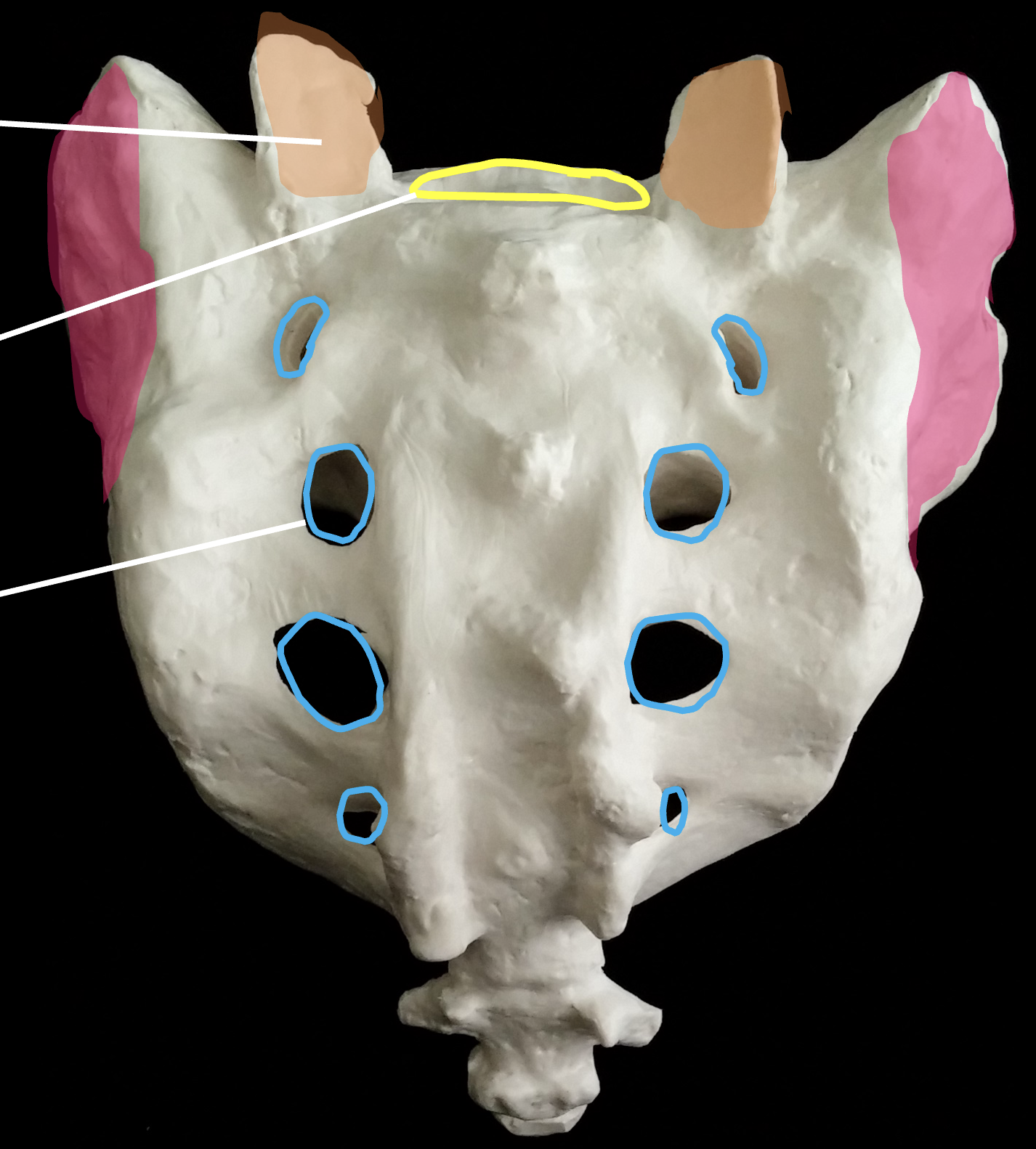<p>What is the pink region highlighted on the sacrum?</p>