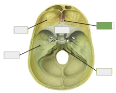 <p>Superior view: this is the</p>