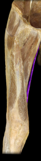 <p>hip adduction, internal rotation, flexion</p>