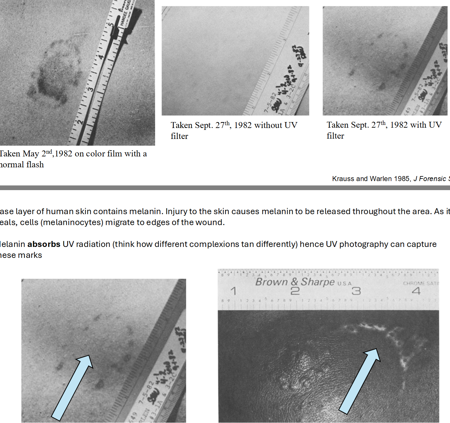 <p>Major types of trace evidence: Bite marks</p>