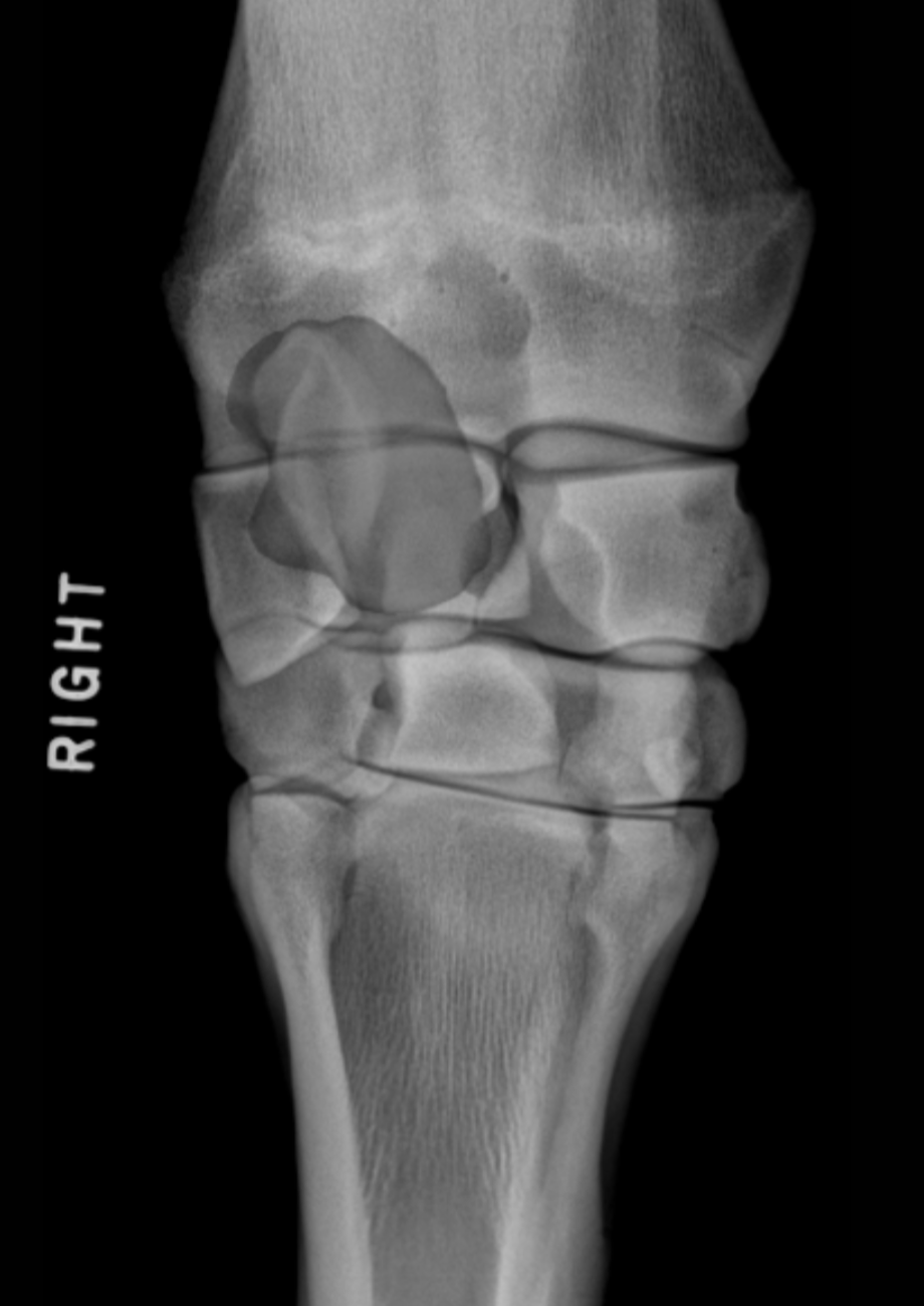 <p>(Eq.) Carpus: Hvilken knogle er dette (D-Pa)</p>