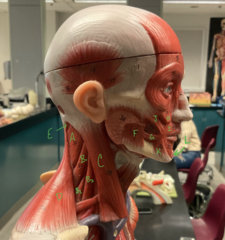 <p>masseter</p>