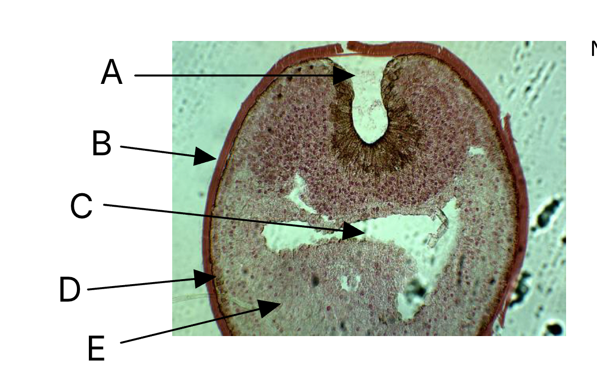 <p>Which letter indicates the gut?</p>