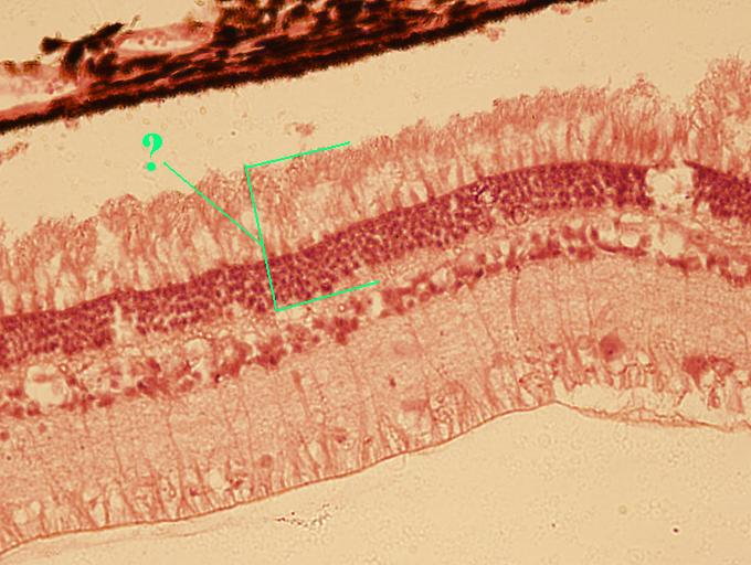 <p>Identify the indicated layer of the retina</p>