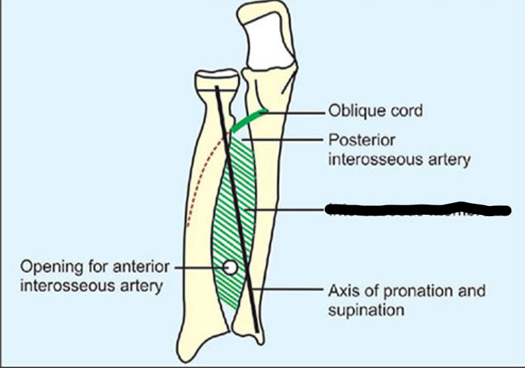 <p>What joint is this within the <strong>Upper-Appendicular Skeleton?</strong></p>